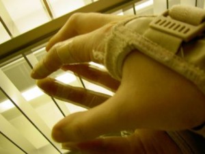 carpal tunnel carpal tunnel